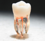     Endodontie Artikel    